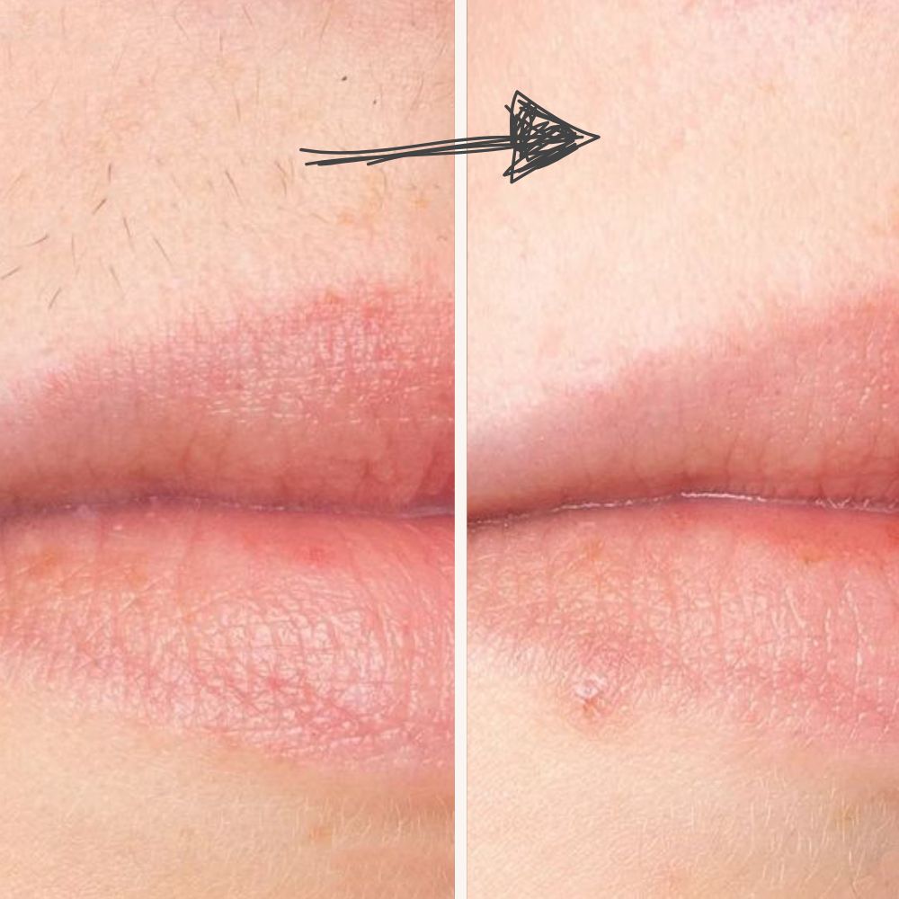 Diamond IPL Pro